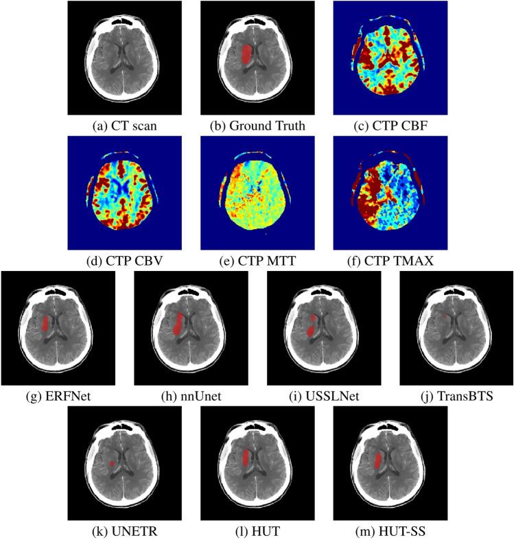 https://cdn.ncbi.nlm.nih.gov/pmc/blobs/ab79/12141671/85a7cb8f56b9/41598_2025_4819_Fig3_HTML.jpg