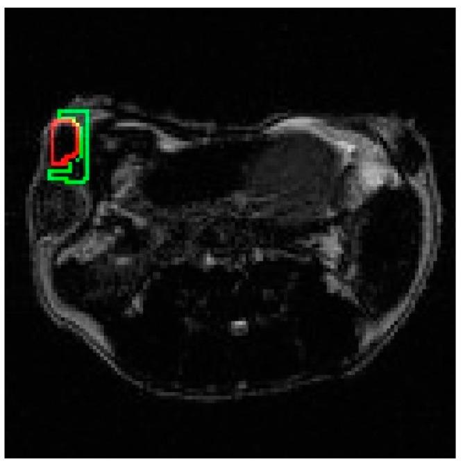https://cdn.ncbi.nlm.nih.gov/pmc/blobs/ab7a/10142138/5530bcdd668d/materials-16-03096-g002.jpg