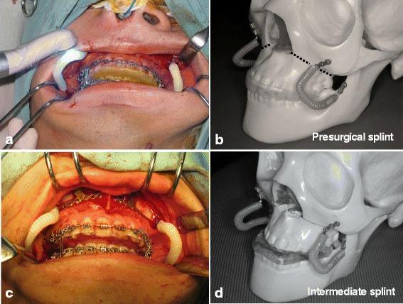 https://cdn.ncbi.nlm.nih.gov/pmc/blobs/ab7c/5126908/45add84940b5/40902_2016_50_Fig5_HTML.jpg