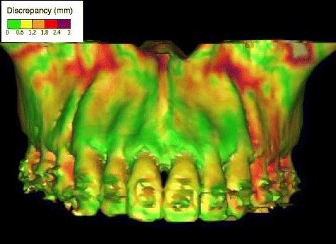 https://cdn.ncbi.nlm.nih.gov/pmc/blobs/ab7c/5126908/691ea8443e05/40902_2016_50_Fig6_HTML.jpg