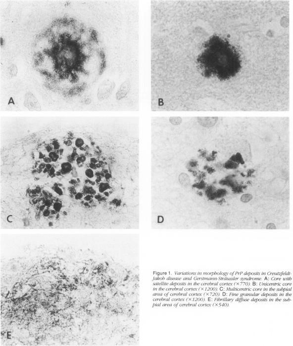 https://cdn.ncbi.nlm.nih.gov/pmc/blobs/ab80/1886224/c192a490ee46/amjpathol00093-0122-a.jpg