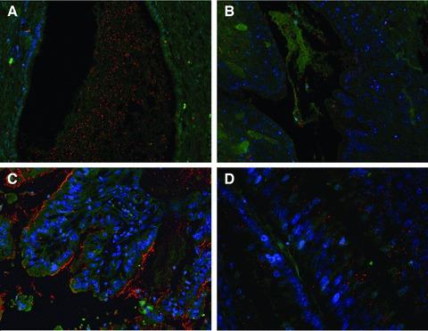 https://cdn.ncbi.nlm.nih.gov/pmc/blobs/ab81/3823216/33ce80aa898f/jcmm0016-1474-f2.jpg