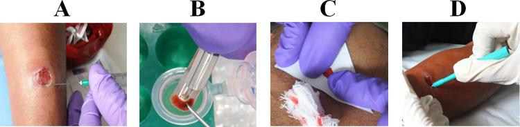 https://cdn.ncbi.nlm.nih.gov/pmc/blobs/ab8b/11045131/73e183eb5971/pntd.0012113.g001.jpg