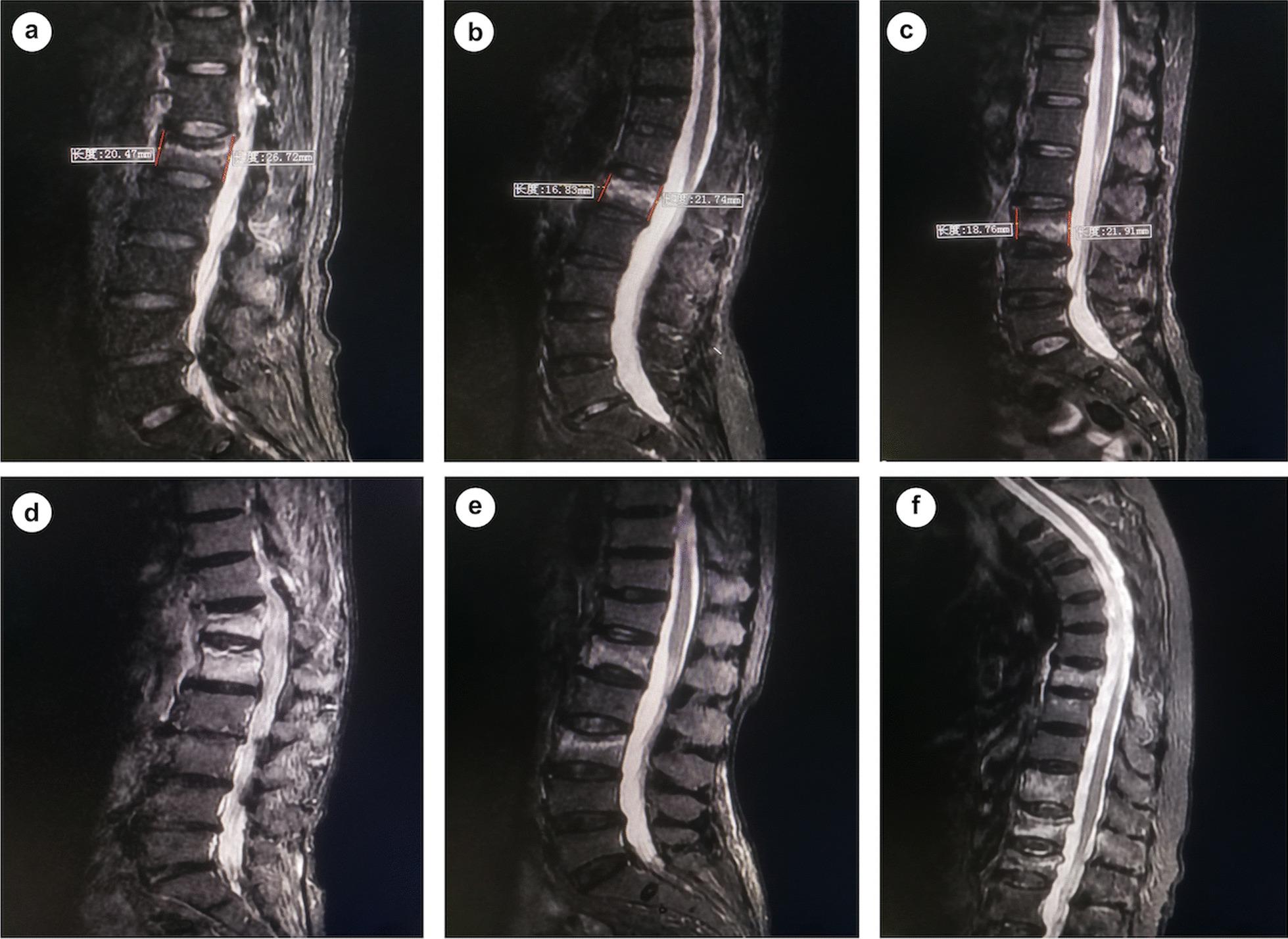 https://cdn.ncbi.nlm.nih.gov/pmc/blobs/ab8d/10224586/19744cd47a53/13018_2023_3874_Fig1_HTML.jpg