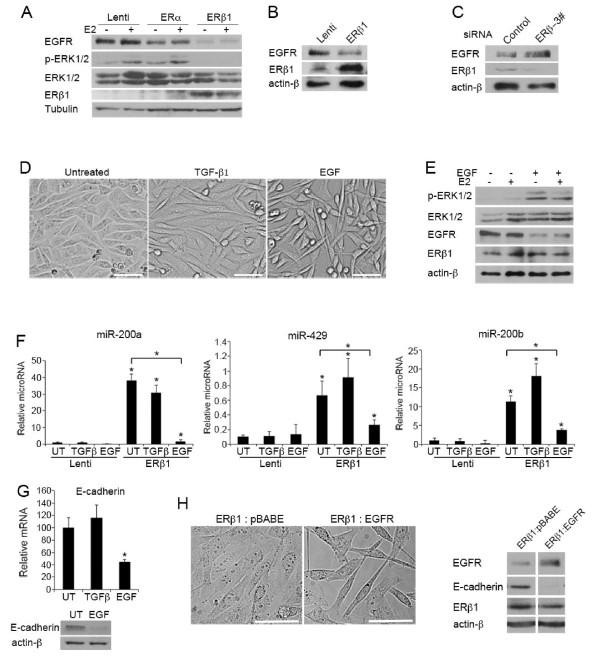 https://cdn.ncbi.nlm.nih.gov/pmc/blobs/ab90/4053135/e2f241894bce/bcr3358-3.jpg
