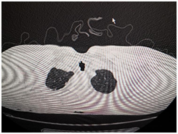 https://cdn.ncbi.nlm.nih.gov/pmc/blobs/ab9b/7705287/52c1d4567919/10.1177_0300060520971498-fig2.jpg