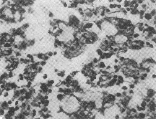https://cdn.ncbi.nlm.nih.gov/pmc/blobs/aba2/1912167/85e5080a1dfb/brmedj02107-0048-b.jpg