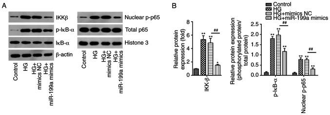 https://cdn.ncbi.nlm.nih.gov/pmc/blobs/aba2/7595662/20276e06db3a/IJMM-46-06-2161-g03.jpg