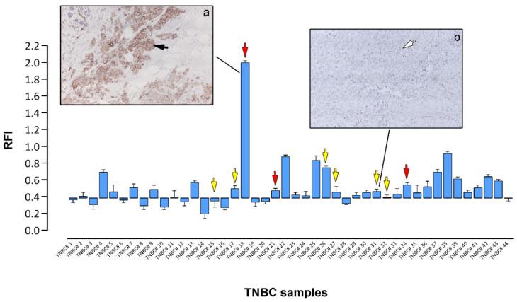 https://cdn.ncbi.nlm.nih.gov/pmc/blobs/aba4/8535076/ef0b1a368371/cells-10-02768-g004.jpg