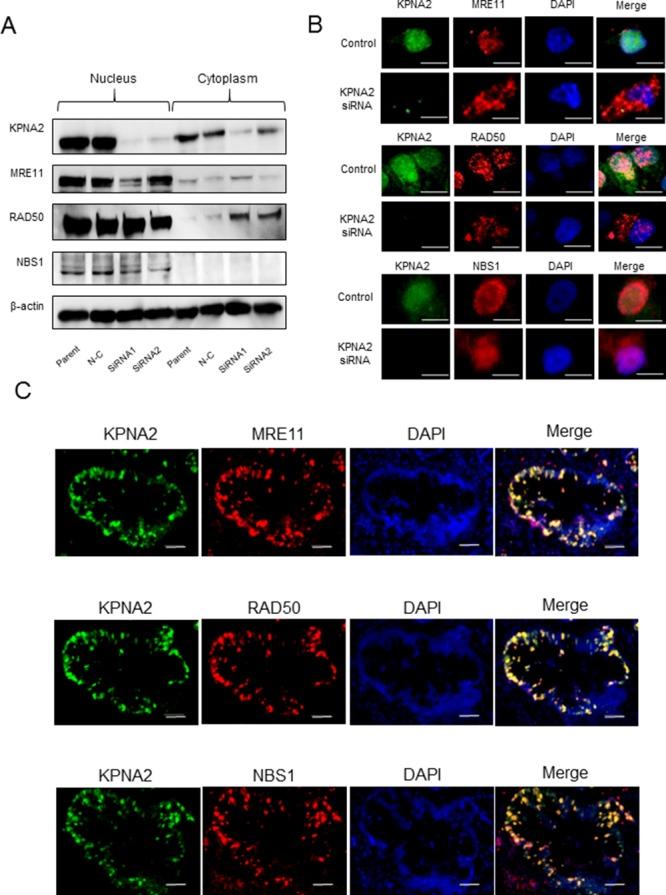 https://cdn.ncbi.nlm.nih.gov/pmc/blobs/abab/5522057/a158f98439b3/oncotarget-08-42159-g004.jpg