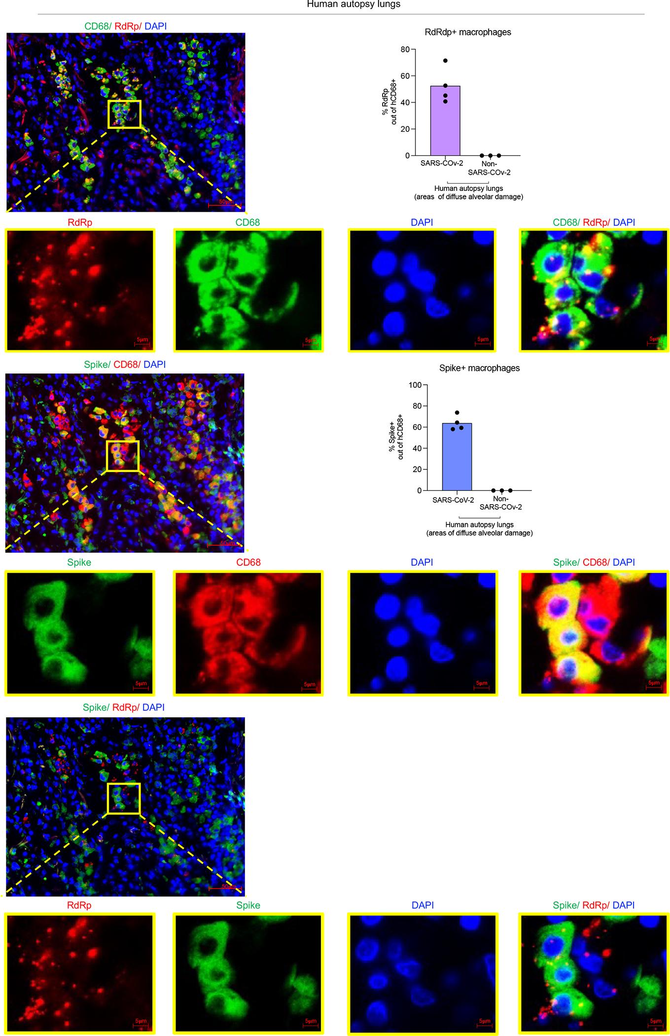 https://cdn.ncbi.nlm.nih.gov/pmc/blobs/abac/9288243/10f0dbde2370/nihms-1809392-f0013.jpg