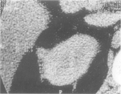 https://cdn.ncbi.nlm.nih.gov/pmc/blobs/abad/2431645/2f4c149ed643/postmedj00144-0065-c.jpg