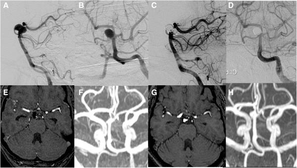 https://cdn.ncbi.nlm.nih.gov/pmc/blobs/abb2/4016604/5229d3344ef0/1752-1947-7-244-3.jpg