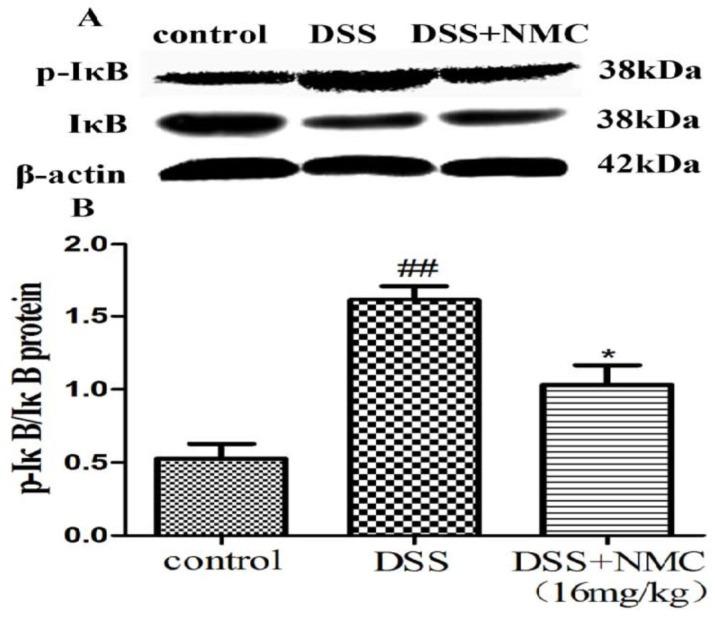 https://cdn.ncbi.nlm.nih.gov/pmc/blobs/abb2/6017650/d1c1dcb00247/molecules-23-00510-g007.jpg