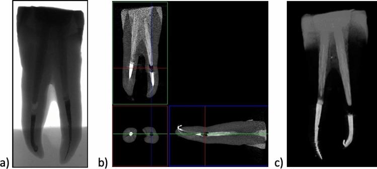 https://cdn.ncbi.nlm.nih.gov/pmc/blobs/abb5/10808276/0053b580b531/10439_2023_3377_Fig5_HTML.jpg
