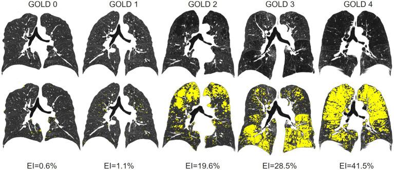 https://cdn.ncbi.nlm.nih.gov/pmc/blobs/abb7/10393128/6c429c518810/fmed-10-1184784-g003.jpg