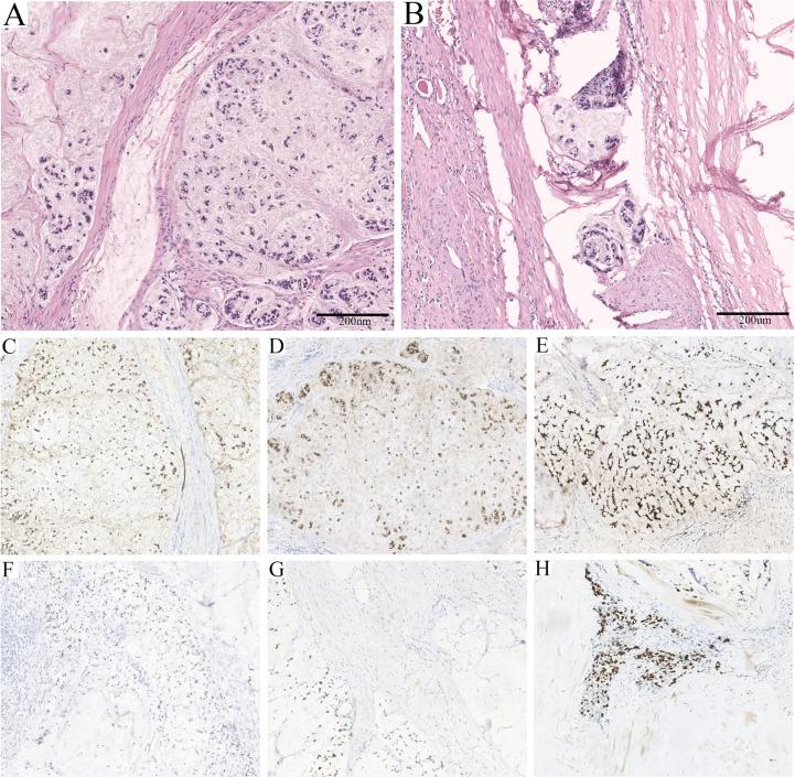 https://cdn.ncbi.nlm.nih.gov/pmc/blobs/abb8/10200912/3790f5e40b94/fonc-13-1129680-g002.jpg