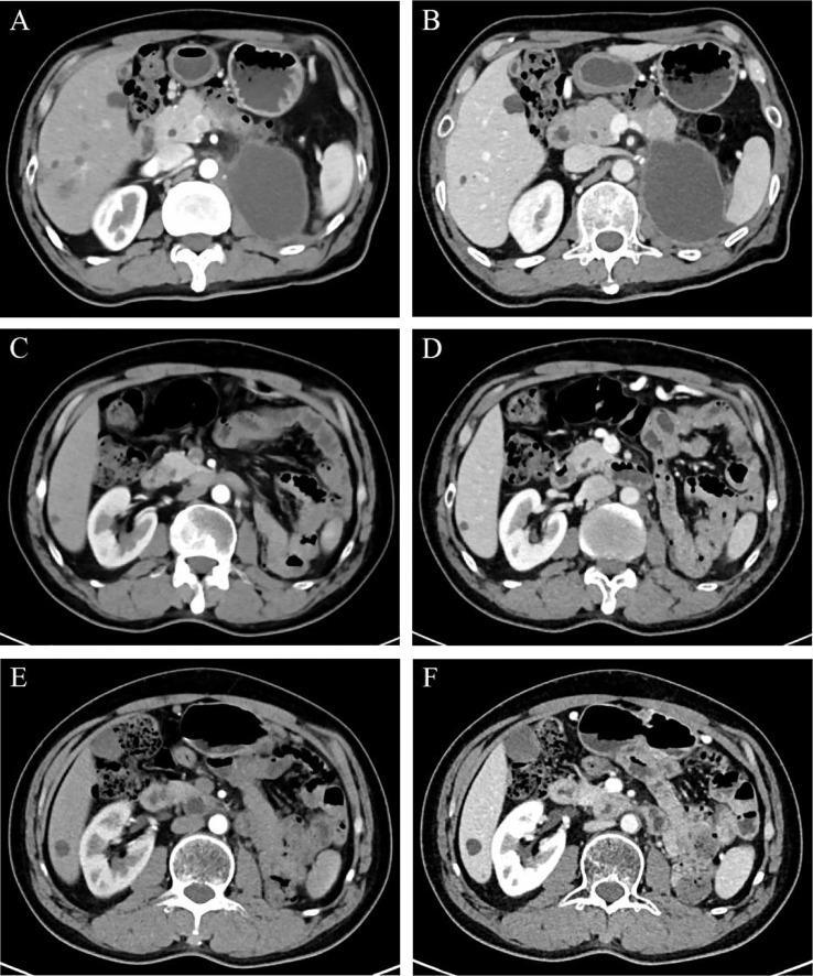 https://cdn.ncbi.nlm.nih.gov/pmc/blobs/abb8/10200912/f3e11a3a5c61/fonc-13-1129680-g004.jpg