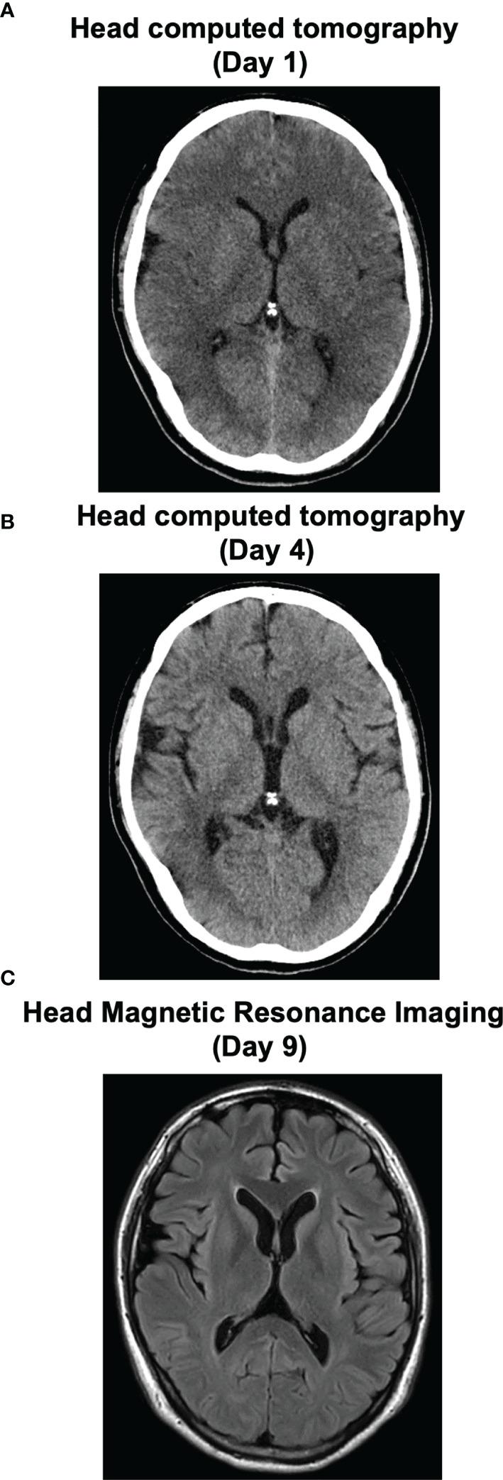 https://cdn.ncbi.nlm.nih.gov/pmc/blobs/abba/8960374/87113342a5e9/fendo-13-822679-g002.jpg