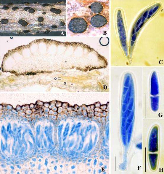https://cdn.ncbi.nlm.nih.gov/pmc/blobs/abbb/2816964/4711177eff9d/1fig1.jpg