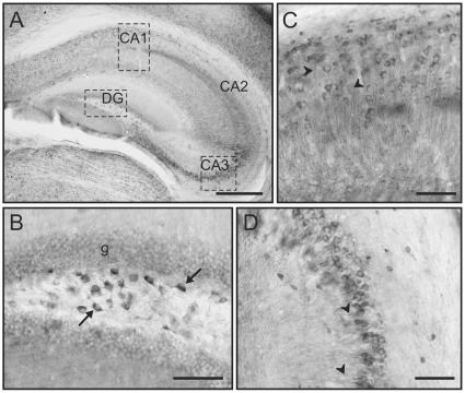 https://cdn.ncbi.nlm.nih.gov/pmc/blobs/abbe/2811740/5c6700d7788f/pone.0008911.g002.jpg