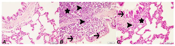 https://cdn.ncbi.nlm.nih.gov/pmc/blobs/abbe/9963576/ea89185d7c9c/pharmaceuticals-16-00221-g004.jpg