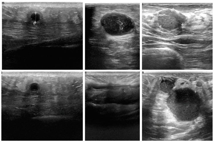 https://cdn.ncbi.nlm.nih.gov/pmc/blobs/abc1/11679931/af18068d4889/tomography-10-00145-g010.jpg