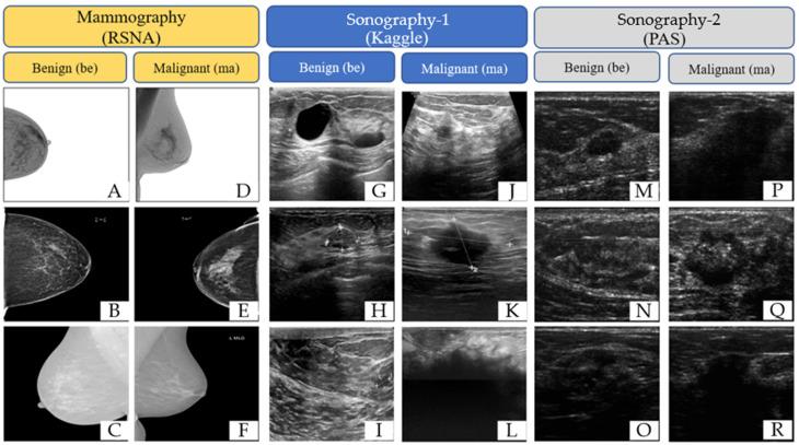 https://cdn.ncbi.nlm.nih.gov/pmc/blobs/abc1/11679931/e8de2a9d2b5b/tomography-10-00145-g002.jpg