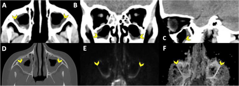 https://cdn.ncbi.nlm.nih.gov/pmc/blobs/abcb/10809606/c8e8a4953526/12880_2024_1196_Fig5_HTML.jpg