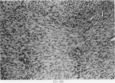 https://cdn.ncbi.nlm.nih.gov/pmc/blobs/abcb/2010226/19eb6647b996/brjcancer00462-0013-b.jpg