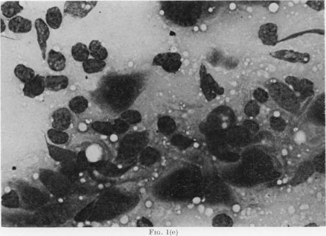 https://cdn.ncbi.nlm.nih.gov/pmc/blobs/abcb/2010226/223625964513/brjcancer00462-0013-a.jpg