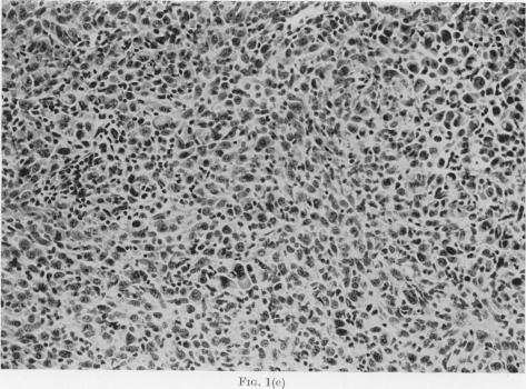https://cdn.ncbi.nlm.nih.gov/pmc/blobs/abcb/2010226/3be9d326a3de/brjcancer00462-0012-a.jpg