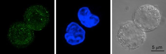 https://cdn.ncbi.nlm.nih.gov/pmc/blobs/abcc/4270222/d4c69d6728d7/phy2-2-e12137-g5.jpg