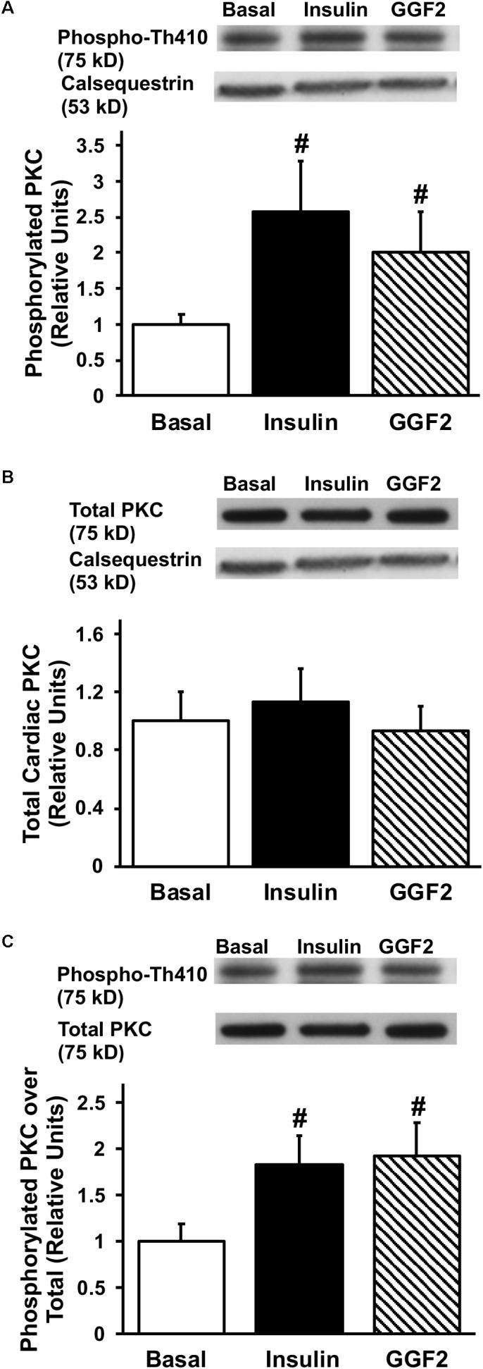 https://cdn.ncbi.nlm.nih.gov/pmc/blobs/abcc/6445869/824bf826c978/fphys-10-00189-g006.jpg