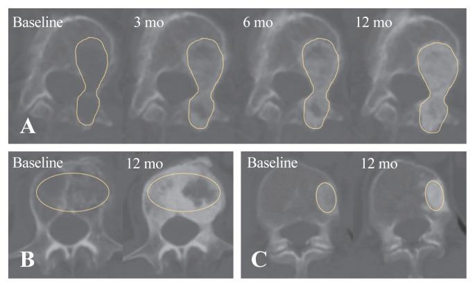 https://cdn.ncbi.nlm.nih.gov/pmc/blobs/abd2/11895105/e089bb3a4529/asj-2024-0334f1.jpg