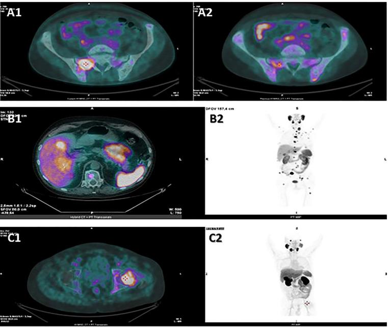 https://cdn.ncbi.nlm.nih.gov/pmc/blobs/abd6/9354022/5e300390fda5/fonc-12-937713-g002.jpg