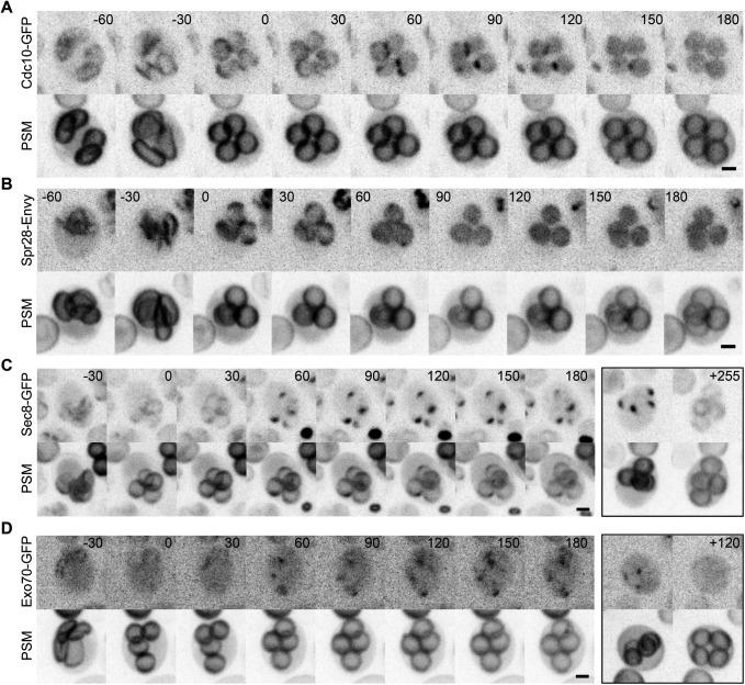 https://cdn.ncbi.nlm.nih.gov/pmc/blobs/abd7/11974964/ee551b454820/mbc-36-ar28-g002.jpg