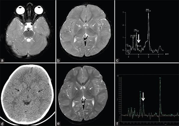 https://cdn.ncbi.nlm.nih.gov/pmc/blobs/abe2/7313585/b2dcda615999/AIAN-23-419-g001.jpg