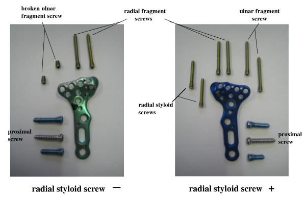 https://cdn.ncbi.nlm.nih.gov/pmc/blobs/abe8/3014894/a07474806bb7/1749-799X-5-90-6.jpg