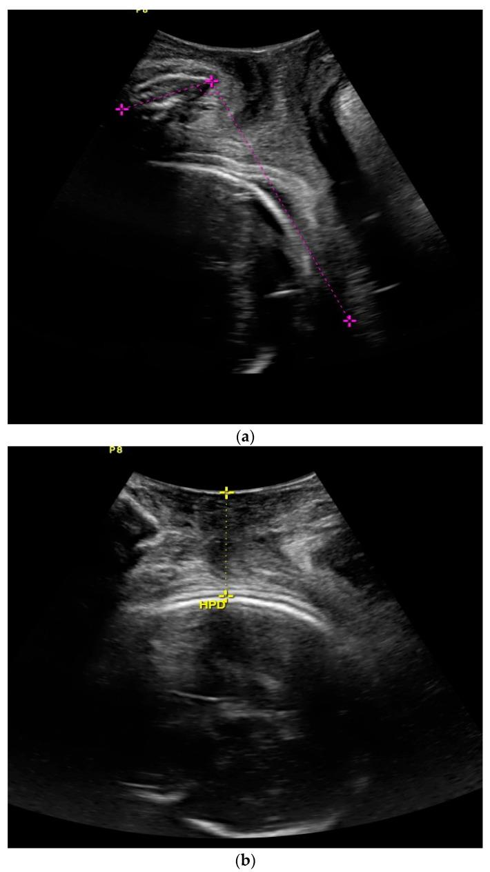 https://cdn.ncbi.nlm.nih.gov/pmc/blobs/abef/12347592/7a68d96c95b8/jcm-14-05283-sch001.jpg