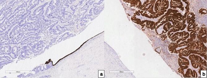 https://cdn.ncbi.nlm.nih.gov/pmc/blobs/abf0/11163451/6fec2f097500/rjae400f3.jpg