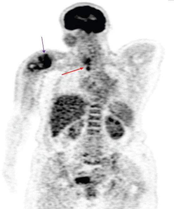 https://cdn.ncbi.nlm.nih.gov/pmc/blobs/abf3/12064254/b6eff470b4e9/JOCR-15-85-g004.jpg