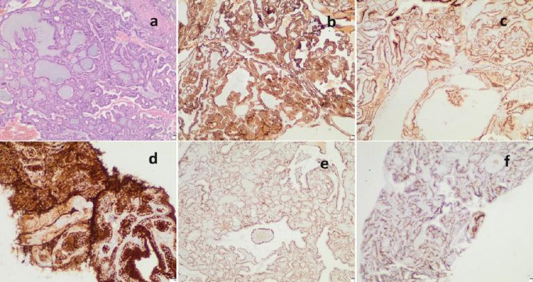 https://cdn.ncbi.nlm.nih.gov/pmc/blobs/abf3/12064254/b7f5053fc922/JOCR-15-85-g005.jpg