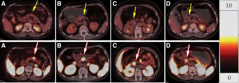 https://cdn.ncbi.nlm.nih.gov/pmc/blobs/abfa/10174405/a35e11337a27/medi-102-e33726-g001.jpg