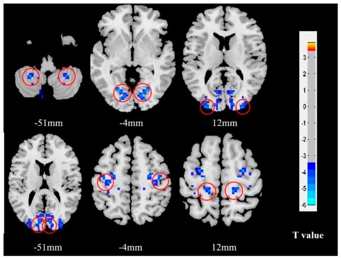 https://cdn.ncbi.nlm.nih.gov/pmc/blobs/ac04/9688662/29393b21f054/brainsci-12-01505-g002.jpg