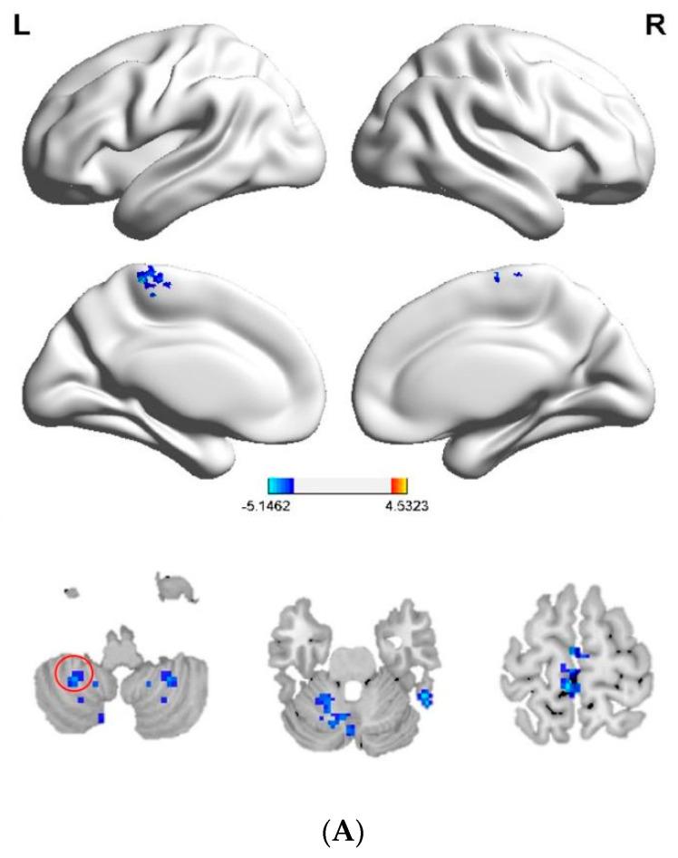 https://cdn.ncbi.nlm.nih.gov/pmc/blobs/ac04/9688662/64efb49423f2/brainsci-12-01505-g003a.jpg