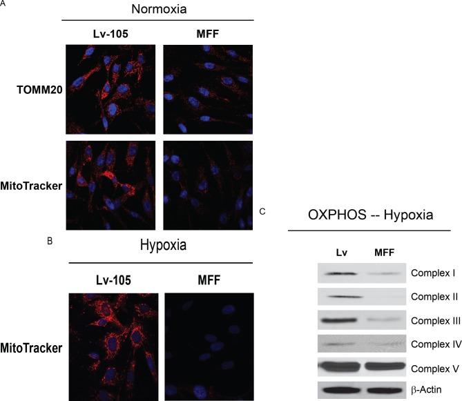 https://cdn.ncbi.nlm.nih.gov/pmc/blobs/ac09/3478457/159244b018e9/oncotarget-08-798-g002.jpg