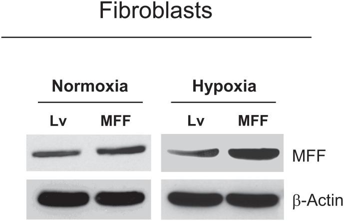 https://cdn.ncbi.nlm.nih.gov/pmc/blobs/ac09/3478457/5bdfa09bd689/oncotarget-08-798-g001.jpg