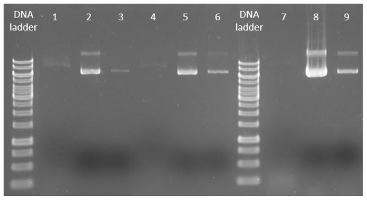 https://cdn.ncbi.nlm.nih.gov/pmc/blobs/ac0e/9917137/ffce9062493a/ijms-24-02156-g007.jpg
