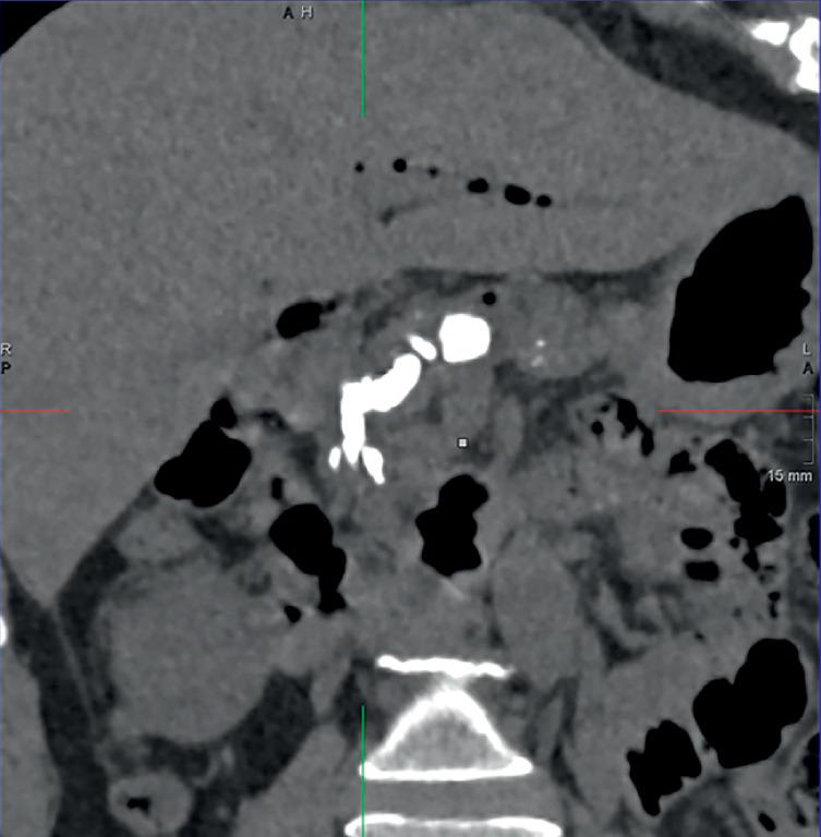https://cdn.ncbi.nlm.nih.gov/pmc/blobs/ac11/11309848/061a33c9cfca/10-1055-a-2361-1299_23612334.jpg